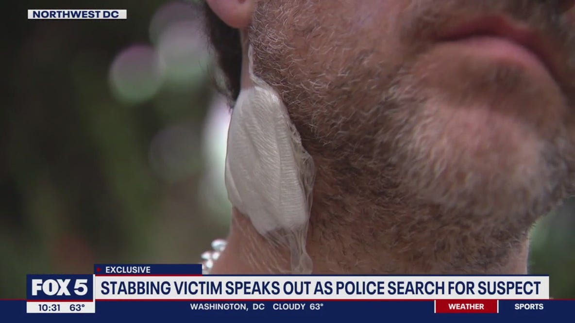 Victim shares terrifying details of 'random' Northwest alley stabbing